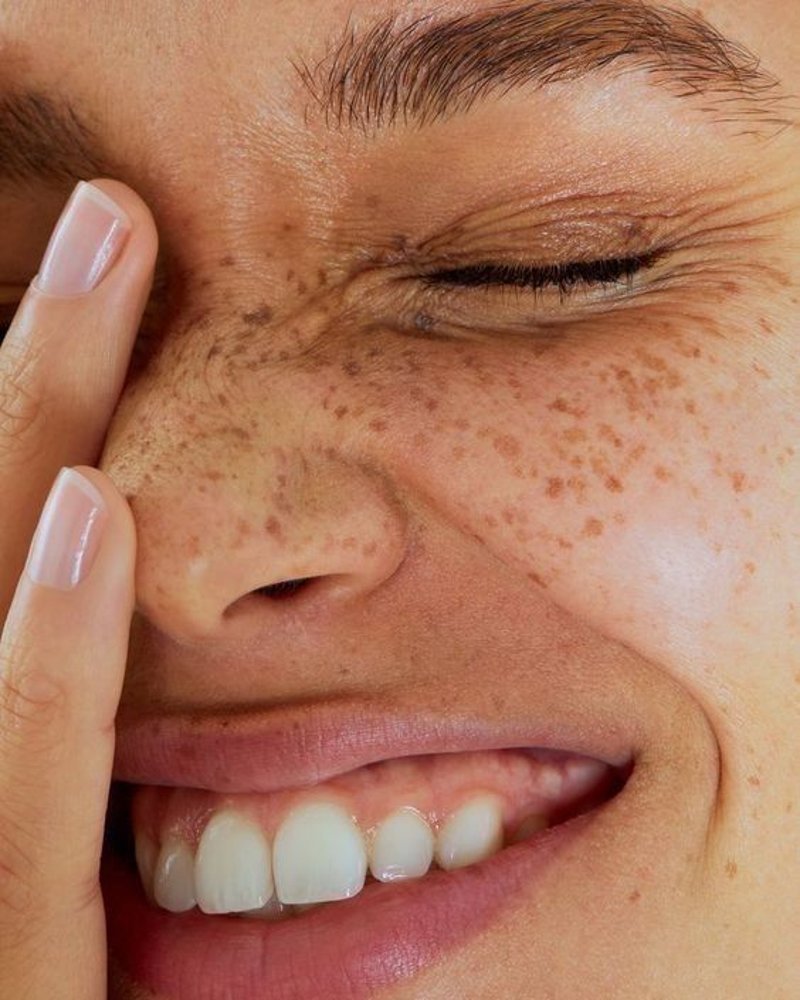 A real Smile On smile, up close